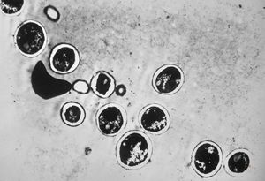 Candida albicans Candida albicans